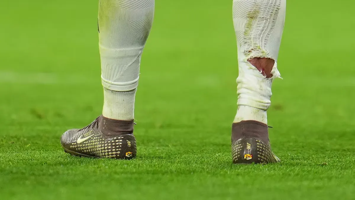 开云体育平台-球袜被直接踢破！姆巴佩遭拜仁后卫塔犯规后，血痕清晰可见